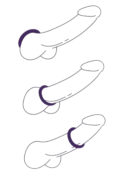 Three stylized illustrations of a penis with a black cock ring on a white background