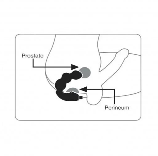 Diagram showing the location of the prostate and perineum with labeled arrows.
